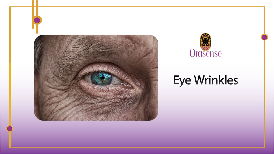 eye wrinkles