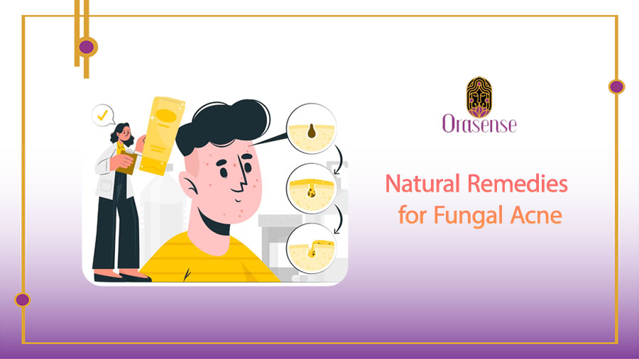 Natural Remedies for Fungal Acne