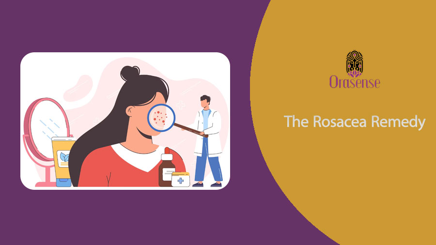 The Rosacea Remedy