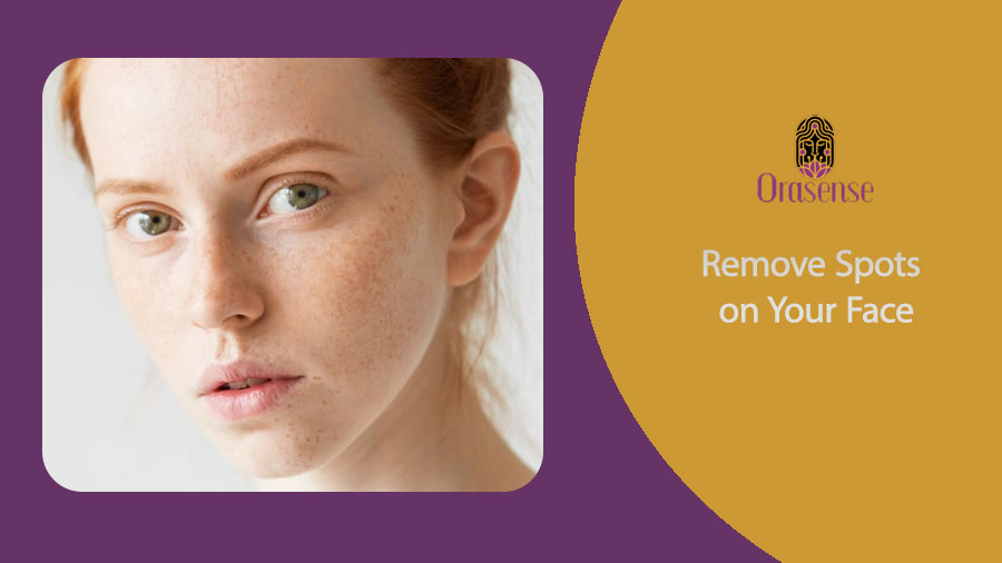 Remove Spots on Your Face