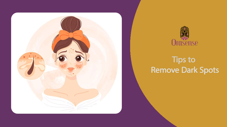 Tips to Remove Dark Spots
