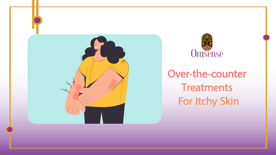 Over-the-counter treatments for itchy skin