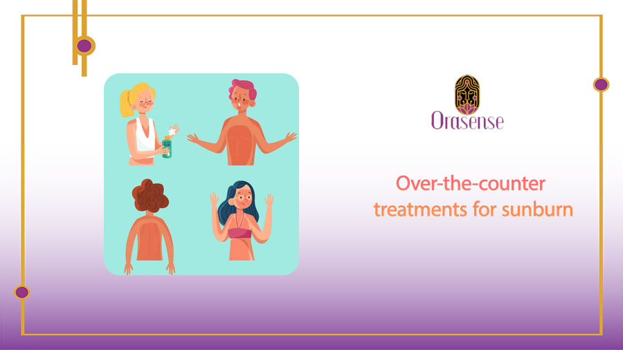 Over-the-counter treatments for sunburn